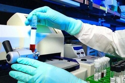 En los centros de trabajo slo se realizarn PCR a casos sospechosos