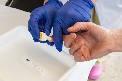 O Estudo de seroprevalencia fronte ao COVID-19 estima que en Galicia estara inmunizada o 1,15% da poboacin