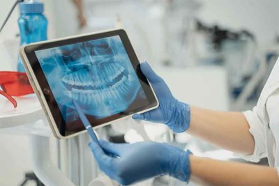 Tecnologa en Odontologa: La Revolucin de las Radiografas Dentales y su Papel en la Salud Bucal