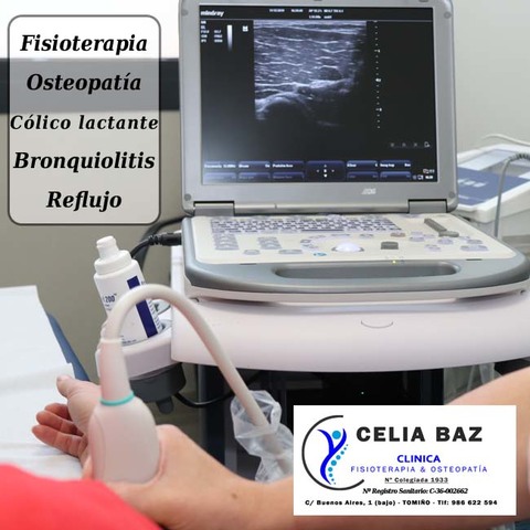 Cl�nica Celia Baz en Tomi�o dispone de uno de los sistemas de ecograf�a m�s avanzados para la valoraci�n de dolencias en Fisioterapia